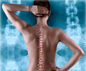 Wirbelsäulenillustration