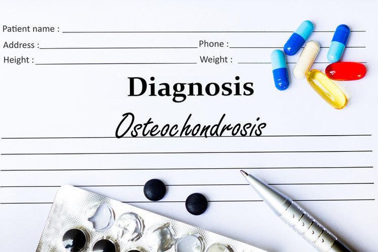 Medikamente zur Diagnose von Osteochondrose