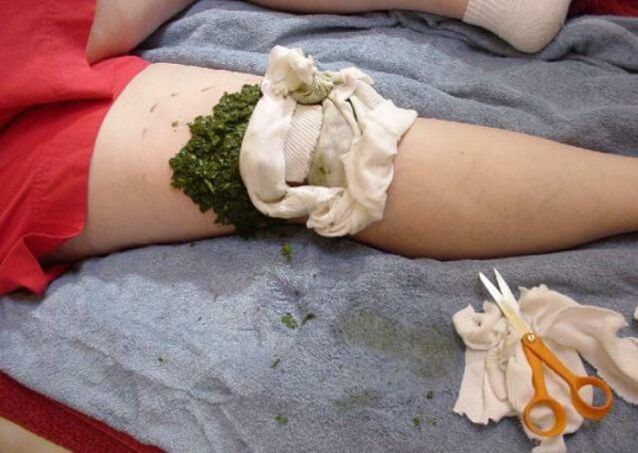 Kompresse bei Arthrose des Kniegelenks.