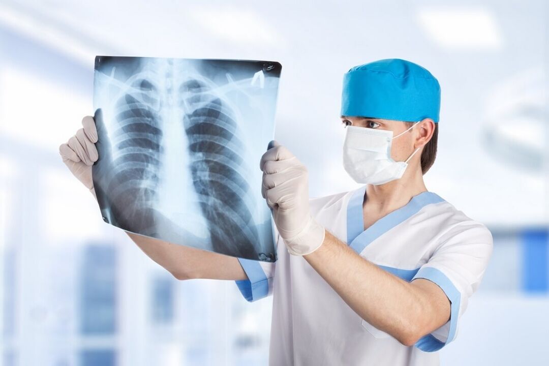 Röntgen der Brust mit Osteochondrose. 