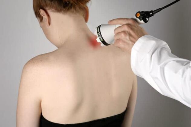 Die Lasertherapie wird zur Bekämpfung von Rückenschmerzen im Schulterblattbereich eingesetzt. 