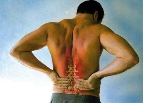 Lumbale Osteochondrose -Schmerzen
